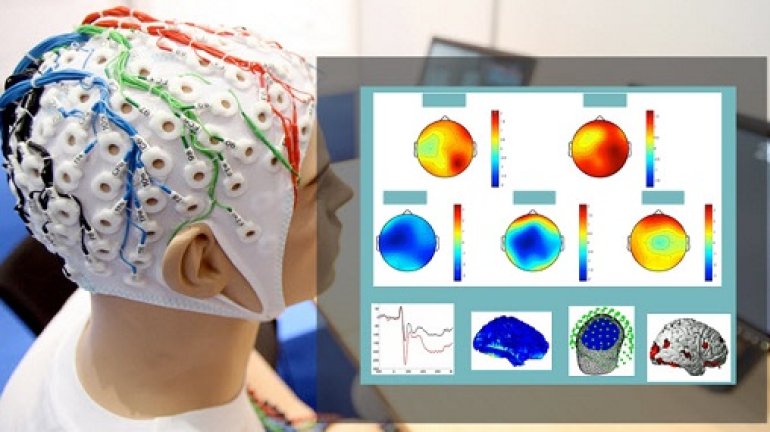 Electroencephalography